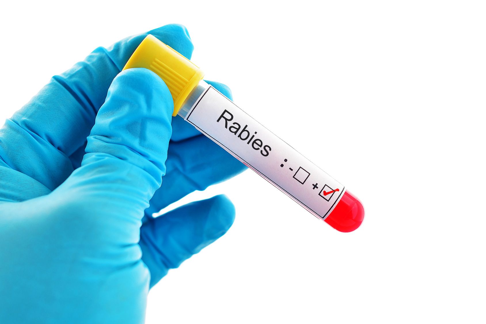 Blood sample positive with rabies virus